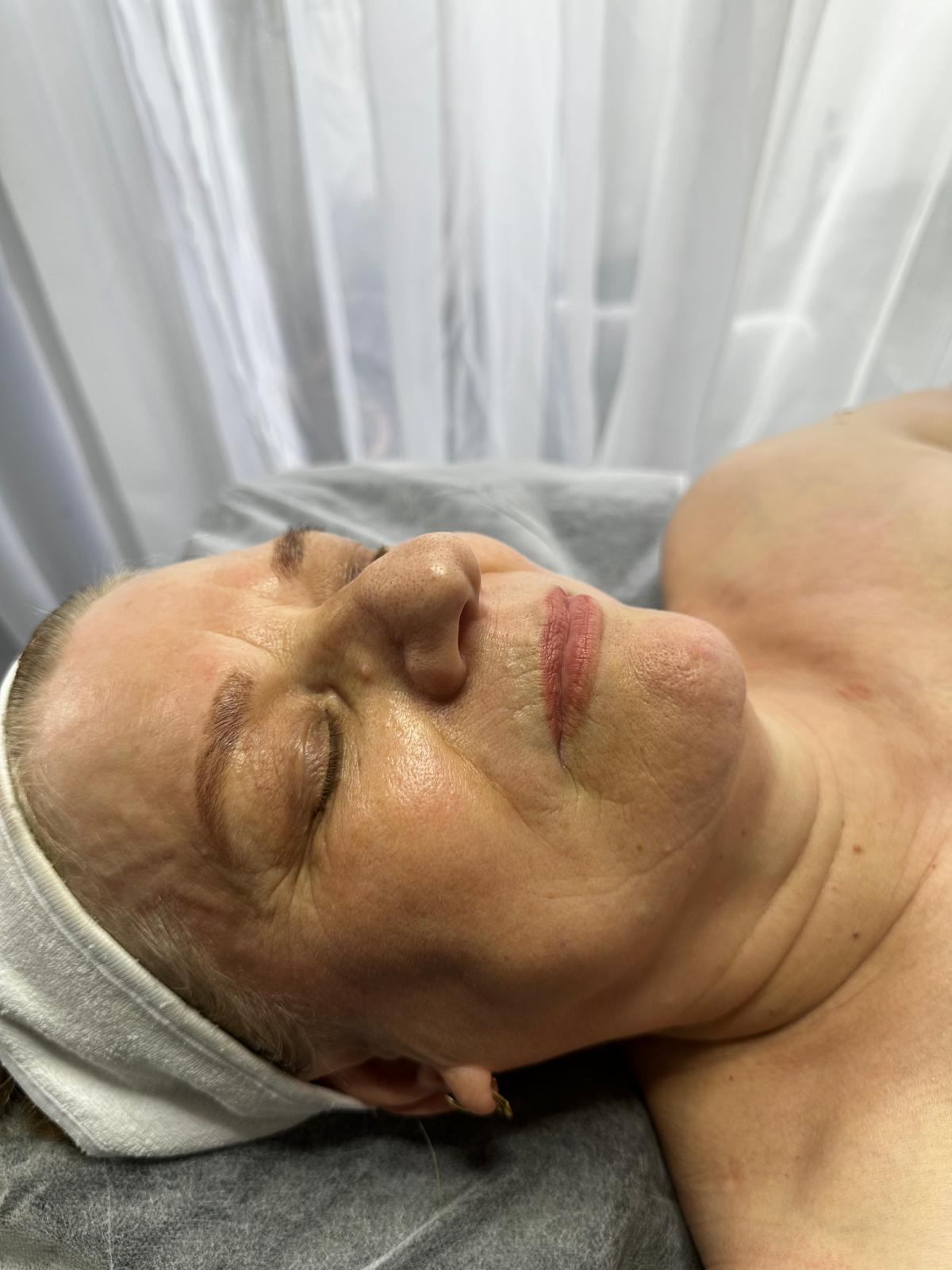 Tratament piele matură — etapa de început