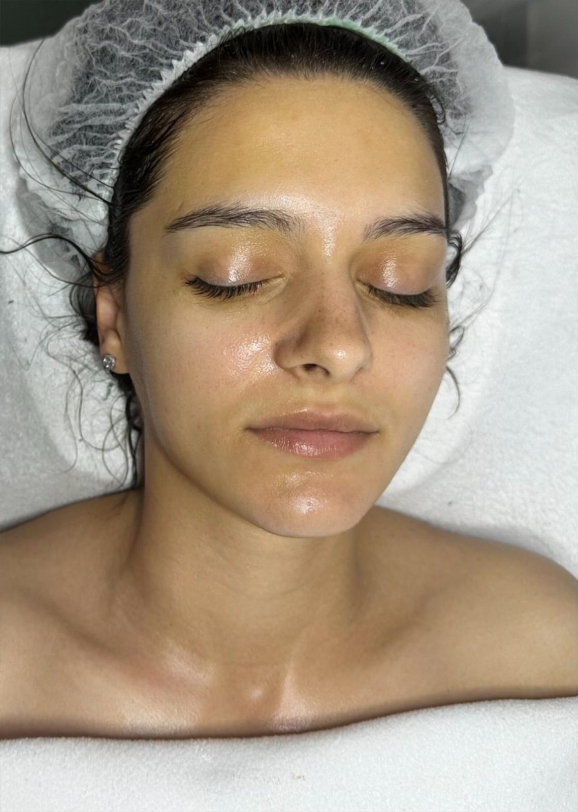 Tratament facial — rezultat final, hidratare profundă