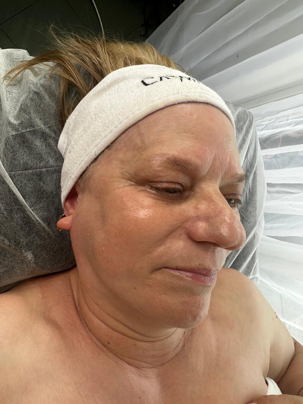 Tratament piele matură — în lucru
