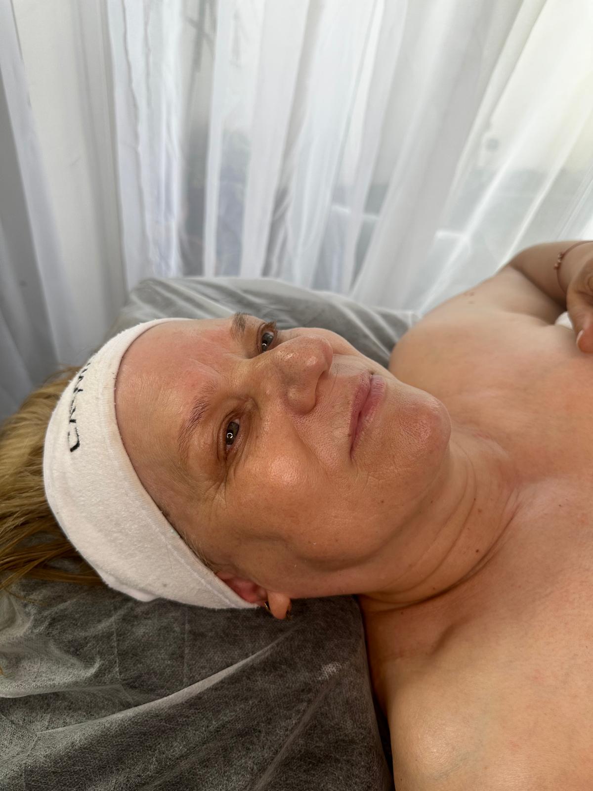 Tratament piele matură — finalizare, ten relaxat și luminos